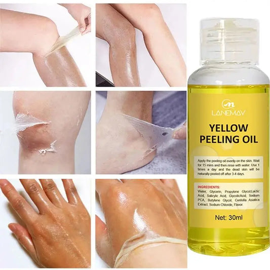Say Goodbye to Dark Spots and Dry Skin with Our Yellow Peeling Oil - Whitening, Moisturizing, and Exfoliating Care for Your Body